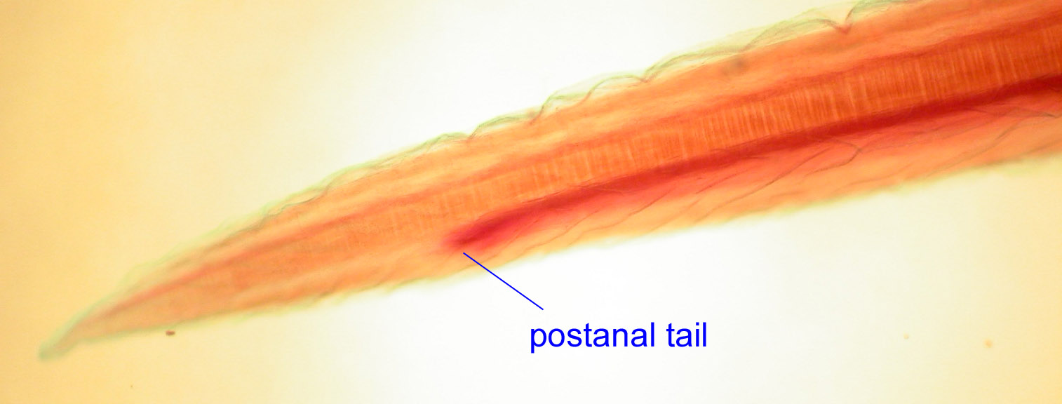 postanal tail