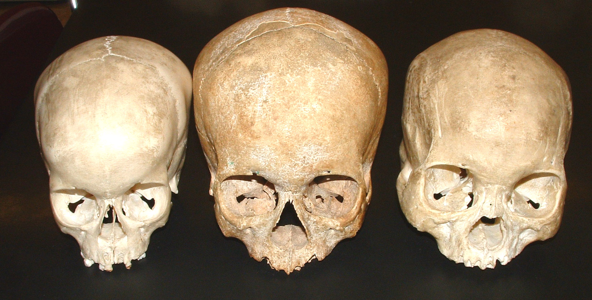 3 skulls